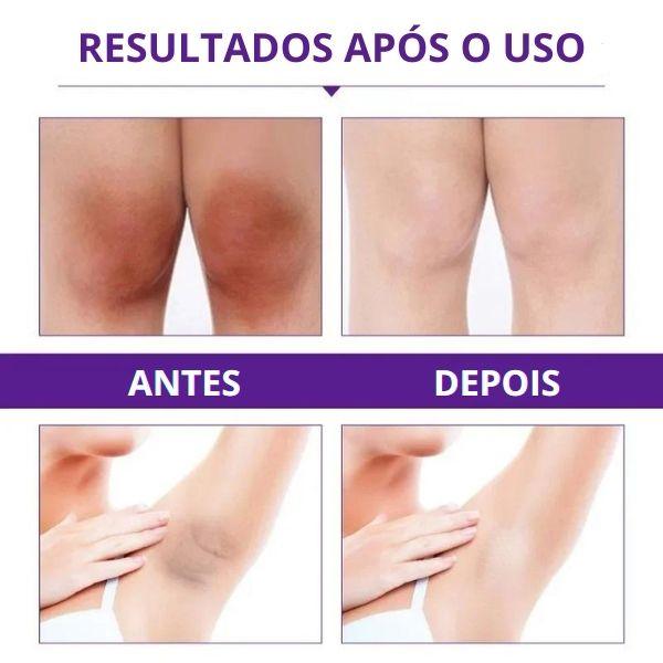 Creme Clareador Axila e Virilha - Sexy Pink - Nacional Shoppe