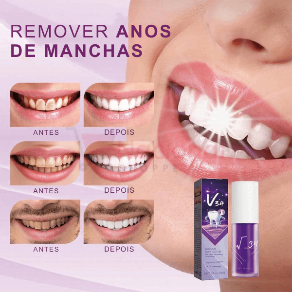 Clareador Dental V34 Original - Dentes Brancos Em Segundos - Nacional Shoppe