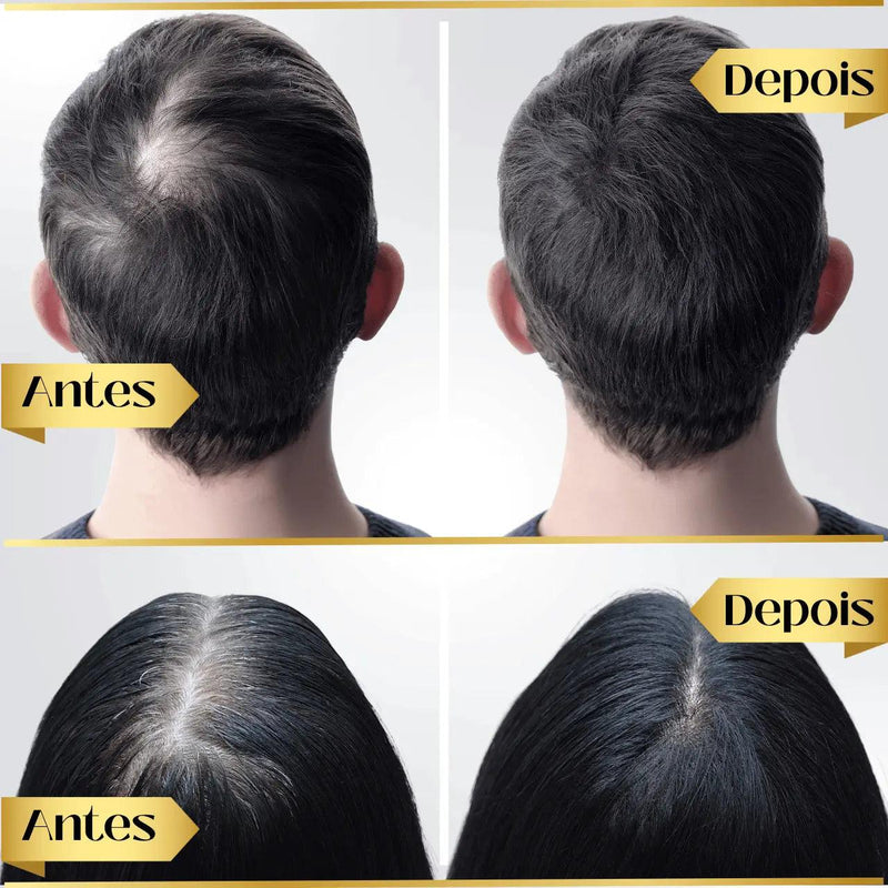 Tônico Capilar Repair Hair® - Crescimento Capilar e Combate à Queda de Cabelo - União Descontos